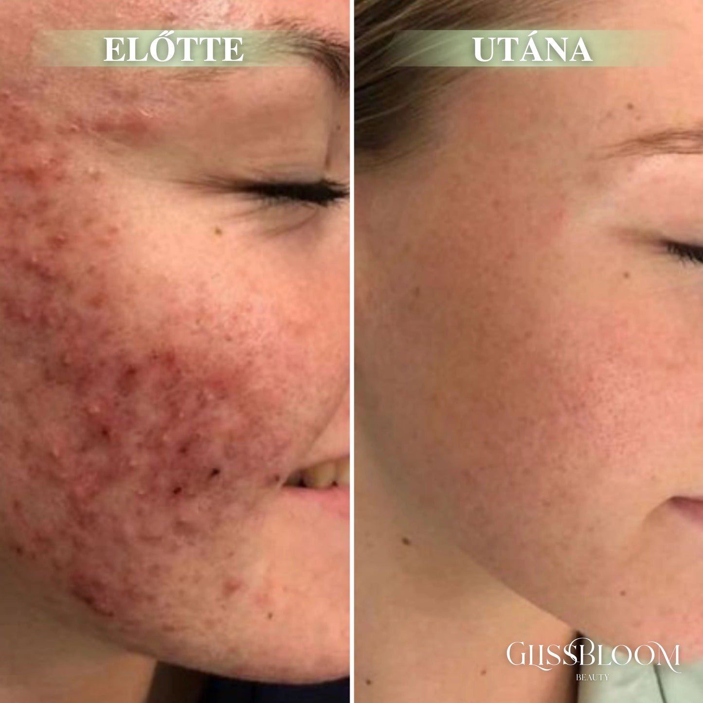 GlissBloom Buborékos Mélytisztító Arcmaszk