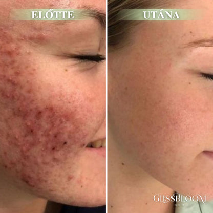 GlissBloom Buborékos Mélytisztító Arcmaszk