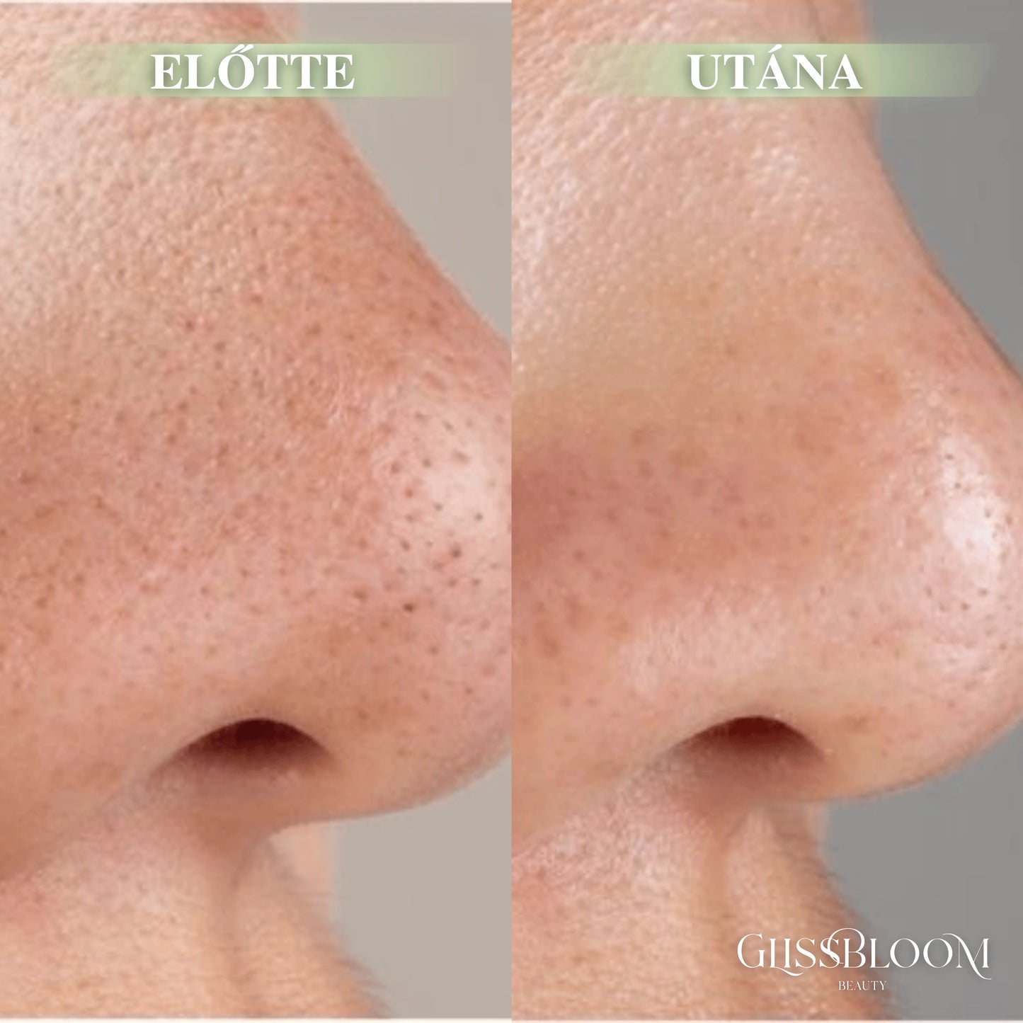 GlissBloom Buborékos Mélytisztító Arcmaszk